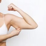 Practical Steps for Effective Arm Fat Removal